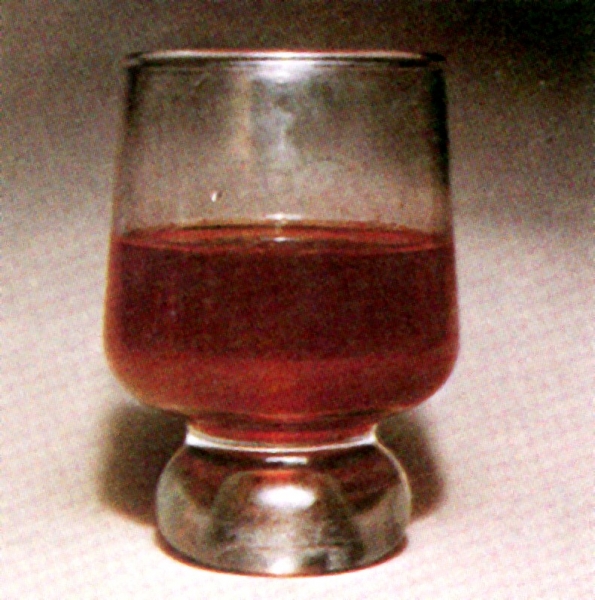 Pseudochromhidrosis: Not Just From Red Wine